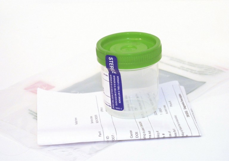 drug testing