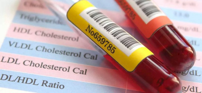 Diagnosis By Hospital Blood Testing diagnosis-by-hospital-blood-testing