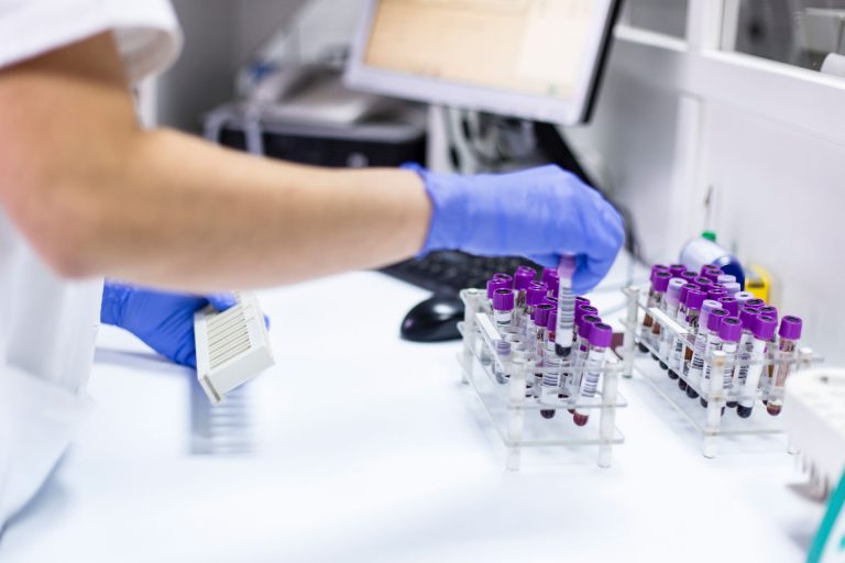 blood testing