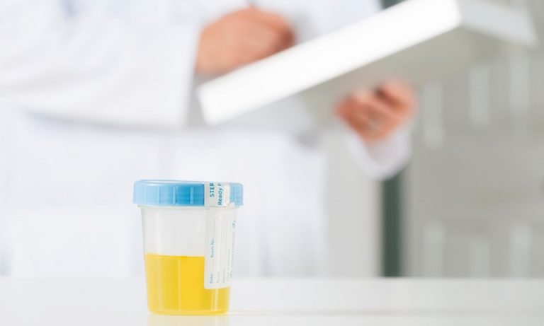 drug testing