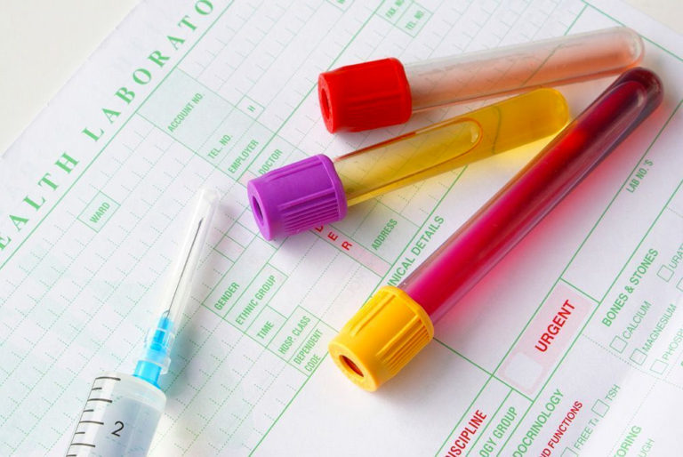 blood testing