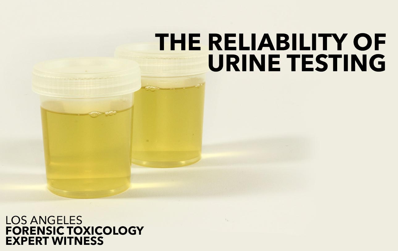 urine testing